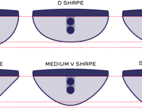 Common neck shape profiles